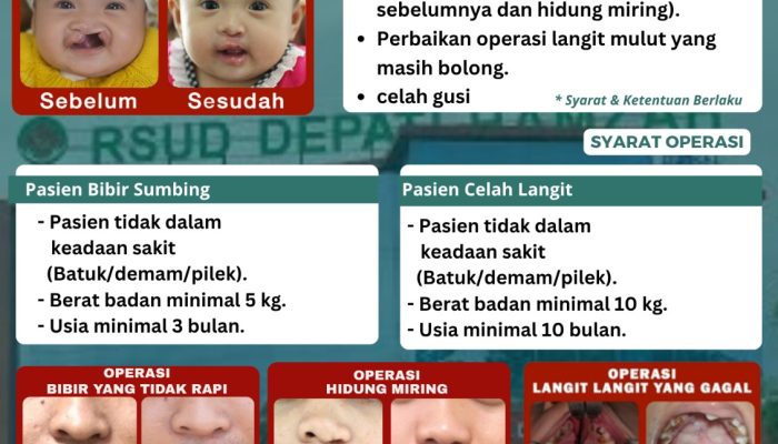 RSUD Depati Hamzah Kota pangkalpinang Buka Baksos Operasi Bibir dan Langit Mulut Sumbing dalam Rangka Dukung Program 100 Hari Kerja